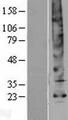 AQP5 / Aquaporin 5 Protein - Western validation with an anti-DDK antibody * L: Control HEK293 lysate R: Over-expression lysate