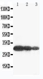 AQP6 / Aquaporin 6 Antibody - WB of AQP6 / Aquaporin 6 antibody. Lane 1: U87 Cell Lysate. Lane 2: COLO320 Cell Lysate. Lane 3: MCF-7 Cell Lysate.