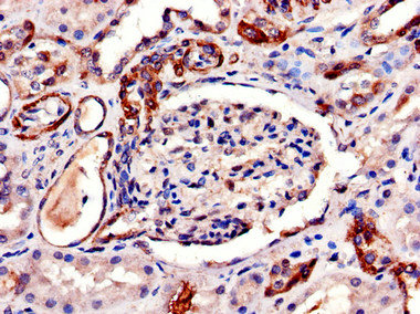 AQP6 / Aquaporin 6 Antibody - Immunohistochemistry of paraffin-embedded human kidney tissue using AQP6 Antibody at dilution of 1:100