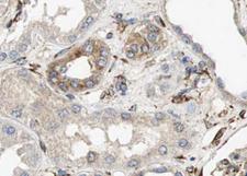 AQP6 / Aquaporin 6 Antibody - 1:100 staining human kidney tissue by IHC-P. The tissue was formaldehyde fixed and a heat mediated antigen retrieval step in citrate buffer was performed. The tissue was then blocked and incubated with the antibody for 1.5 hours at 22°C. An HRP conjugated goat anti-rabbit antibody was used as the secondary.