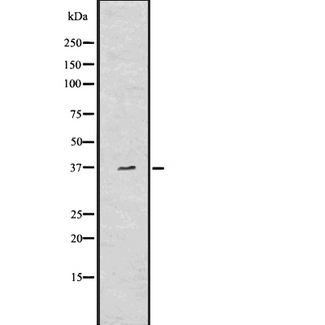 AQP7 / Aquaporin 7 Antibody - Western blot analysis of Aquaporin 7 using Jurkat whole lysates.
