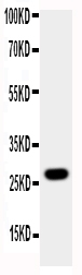 AQP8 / Aquaporin 8 Antibody - Anti-Aquaporin 8 antibody, Western blotting All lanes: Anti Aquaporin 8 at 0.5ug/ml WB: A431 Whole Cell Lysate at 40ug Predicted bind size: 27KD Observed bind size: 27KD
