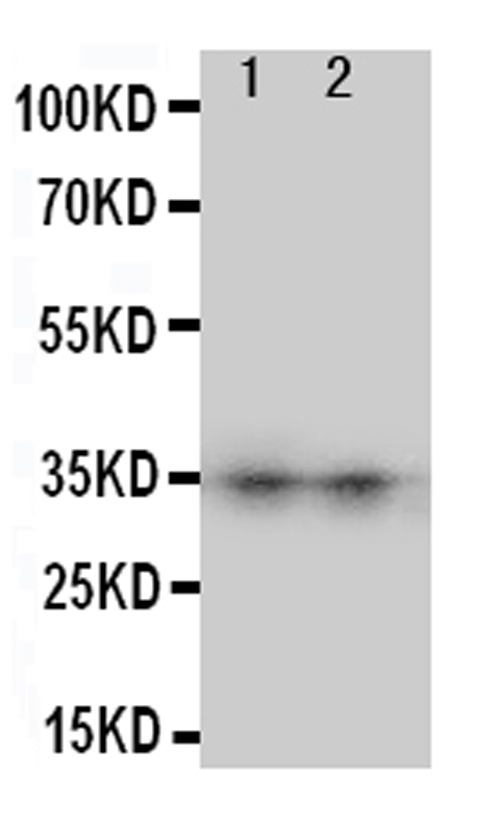 AQP8 / Aquaporin 8 Antibody - Anti-Aquaporin 8 antibody, Western blotting Lane 1: SW620 Cell LysateLane 2: COLO320 Cell Lysate