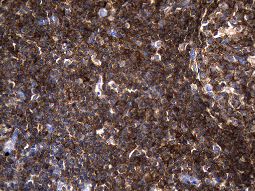 AQP8 / Aquaporin 8 Antibody - Immunohistochemical staining of paraffin-embedded Human tonsil within the normal limits using anti-AQP8 mouse monoclonal antibody. (Heat-induced epitope retrieval by 1mM EDTA in 10mM Tris buffer. (pH8.5) at 120°C for 3 min. (1:2000)