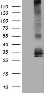 AQP8 / Aquaporin 8 Antibody - HEK293T cells were transfected with the pCMV6-ENTRY control. (Left lane) or pCMV6-ENTRY AQP8. (Right lane) cDNA for 48 hrs and lysed