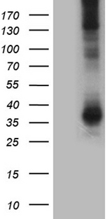 AQP8 / Aquaporin 8 Antibody - HEK293T cells were transfected with the pCMV6-ENTRY control. (Left lane) or pCMV6-ENTRY AQP8. (Right lane) cDNA for 48 hrs and lysed. Equivalent amounts of cell lysates. (5 ug per lane) were separated by SDS-PAGE and immunoblotted with anti-AQP8. (1:500)