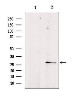 AQP8 / Aquaporin 8 Antibody - Western blot analysis of extracts of mouse brain tissue using AQP8 antibody. Lane 1 was treated with the blocking peptide.