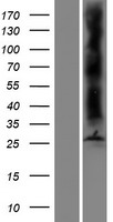 AQP8 / Aquaporin 8 Protein - Western validation with an anti-DDK antibody * L: Control HEK293 lysate R: Over-expression lysate
