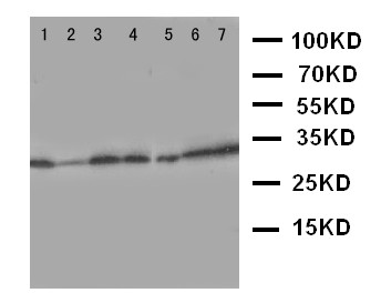 AQP9 / Aquaporin 9 Antibody - WB of AQP9 / Aquaporin 9 antibody. Lane 1: Mouse Liver Tissue Lysate. Lane 2: Mouse Lung Tissue Lysate. Lane 3: Mouse Spleen Tissue Lysate. Lane 4: Mouse Testis Tissue Lysate. Lane 5: PC-12 Cell Lysate. Lane 6: NIH3T3 Cell Lysate. Lane 7: HEPA Cell Lysate.
