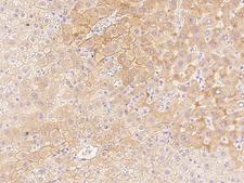 AQP9 / Aquaporin 9 Antibody - Immunochemical staining of human Aquaporin 9 in human liver with rabbit polyclonal antibody at 1:500 dilution, formalin-fixed paraffin embedded sections.