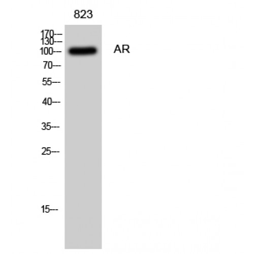AR / Androgen Receptor Antibody - Western blot of AR antibody
