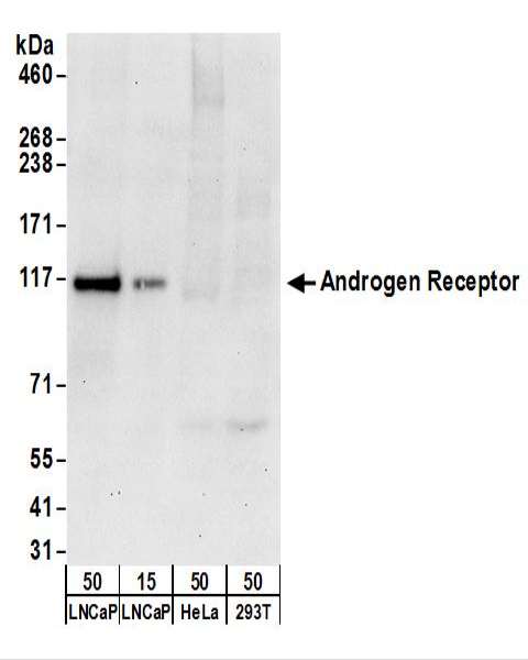 AR / Androgen Receptor Antibody - Detection of Human Androgen Receptor by Western Blot. Samples: Whole cell lysate from LNCaP (15 and 50 ug), HeLa (50 ug), and 293T (50 ug) cells. Antibodies: Affinity purified rabbit anti-Androgen Receptor antibody used for WB at 0.4 ug/ml. Detection: Chemiluminescence with an exposure time of 30 seconds.
