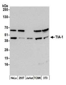AR / Androgen Receptor Antibody - Detection of human and mouse TIA-1 by western blot. Samples: Whole cell lysate from HeLa (15 µg), HEK293T (15 µg), Jurkat (15 µg), mouse TCMK-1 (50µg), and mouse NIH 3T3 (50µg) cells prepared using NETN lysis buffer. Antibody: Affinity purified rabbit anti-TIA-1 antibody used for WB at 0.1 µg/ml. Detection: Chemiluminescence with an exposure time of 3 minutes.