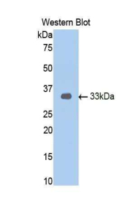 AR / Androgen Receptor Antibody - Western blot of recombinant AR / Androgen Receptor.  This image was taken for the unconjugated form of this product. Other forms have not been tested.