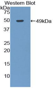 AR / Androgen Receptor Antibody - Western blot of recombinant AR / Androgen Receptor.