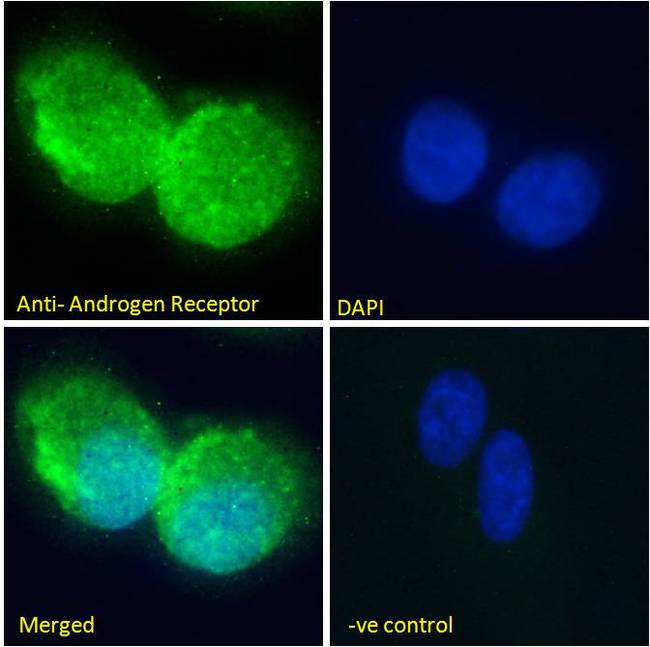 AR / Androgen Receptor Antibody - AR / Androgen Receptor antibody immunofluorescence analysis of paraformaldehyde fixed U2OS cells, permeabilized with 0.15% Triton. Primary incubation 1hr (10ug/ml) followed by Alexa Fluor 488 secondary antibody (2ug/ml), showing Mitochondrial/cytoplasmic staining. The nuclear stain is DAPI (blue). Negative control: Unimmunized goat IgG (10ug/ml) followed by Alexa Fluor 488 secondary antibody (2ug/ml).
