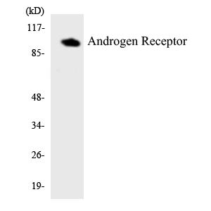 AR / Androgen Receptor Antibody - Western blot analysis of the lysates from COLO205 cells using Androgen Receptor antibody.