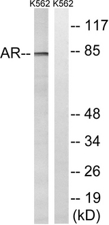 AR / Androgen Receptor Antibody - Western blot analysis of lysates from K562 cells, treated with EGF 200ng/ml 5', using Androgen Receptor Antibody. The lane on the right is blocked with the synthesized peptide.