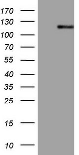 AR / Androgen Receptor Antibody - HEK293T cells were transfected with the pCMV6-ENTRY control. (Left lane) or pCMV6-ENTRY AR. (Right lane) cDNA for 48 hrs and lysed. Equivalent amounts of cell lysates. (5 ug per lane) were separated by SDS-PAGE and immunoblotted with anti-AR. (1:2000)