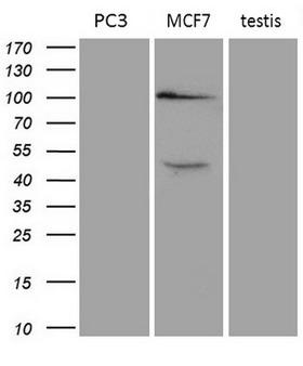 AR / Androgen Receptor Antibody - Western blot analysis of extracts. (35ug) from 2 different cell lines and 1human testis lyste by using anti-AR monoclonal antibody ; MCF7: human testis:human). (1:200)