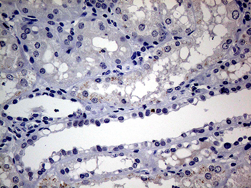 AR / Androgen Receptor Antibody - Immunohistochemical staining of paraffin-embedded Human Kidney tissue within the normal limits using anti-AR mouse monoclonal antibody. This figure shows negative staining. (Heat-induced epitope retrieval by 1mM EDTA in 10mM Tris buffer. (pH8.5) at 120°C for 3 min. (1:1000)
