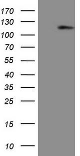AR / Androgen Receptor Antibody - HEK293T cells were transfected with the pCMV6-ENTRY control. (Left lane) or pCMV6-ENTRY AR. (Right lane) cDNA for 48 hrs and lysed. Equivalent amounts of cell lysates. (5 ug per lane) were separated by SDS-PAGE and immunoblotted with anti-AR. (1:2000)