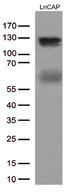 AR / Androgen Receptor Antibody - Western blot analysis of extracts. (35ug) from LNCAP cells by using anti-AR monoclonal antibody. (1:500)