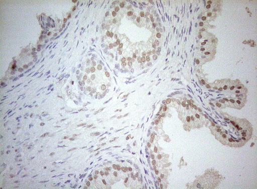 AR / Androgen Receptor Antibody - Immunohistochemical staining of paraffin-embedded Human prostate tissue within the normal limits using anti-AR mouse monoclonal antibody. (Heat-induced epitope retrieval by 1mM EDTA in 10mM Tris buffer. (pH8.5) at 120°C for 3 min. (1:150)