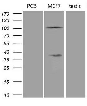 AR / Androgen Receptor Antibody - Western blot analysis of extracts. (35ug) from 2 different cell lines and 1 human testis lyste by using anti-AR monoclonal antibody. (PC-3:human; MCF7: human;Testis:human). (1:200)