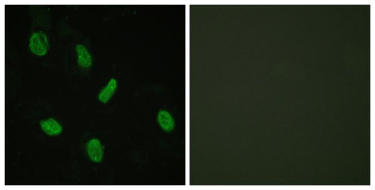 AR / Androgen Receptor Antibody - Peptide - + Immunofluorescence analysis of HeLa cells, using Androgen Receptor antibody.