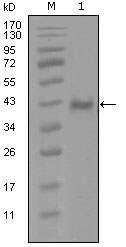 AR / Androgen Receptor Antibody - Western blot using AR mouse monoclonal antibody against truncated Trx-AR recombinant protein (1).