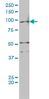 AR / Androgen Receptor Antibody - AR monoclonal antibody (M01), clone 1G3 Western blot of AR expression in HeLa NE.