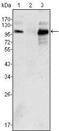 AR / Androgen Receptor Antibody - Western Blot: Androgen Receptor Antibody (2H8) - Western blot analysis using Androgen Receptor mouse mAb against K562 (1), Jurkat (2) and LNCaP (3) cell lysates.  This image was taken for the unconjugated form of this product. Other forms have not been tested.