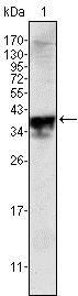 AR / Androgen Receptor Antibody - Western Blot: Androgen Receptor Antibody (2H8) - Western blot analysis using Androgen Receptor mouse mAb against Androgen Receptor (aa221-321)-hIgGFc transfected HEK293 cell lysate.  This image was taken for the unconjugated form of this product. Other forms have not been tested.