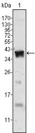 AR / Androgen Receptor Antibody - Western Blot: Androgen Receptor Antibody (2H8) - Western blot analysis using Androgen Receptor mouse mAb against human recombinant Androgen Receptor.  This image was taken for the unconjugated form of this product. Other forms have not been tested.