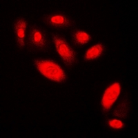 AR / Androgen Receptor Antibody - Immunofluorescent analysis of Androgen Receptor staining in HEK293T cells. Formalin-fixed cells were permeabilized with 0.1% Triton X-100 in TBS for 5-10 minutes and blocked with 3% BSA-PBS for 30 minutes at room temperature. Cells were probed with the primary antibody in 3% BSA-PBS and incubated overnight at 4 deg C in a humidified chamber. Cells were washed with PBST and incubated with a DyLight 594-conjugated secondary antibody (red) in PBS at room temperature in the dark. DAPI was used to stain the cell nuclei (blue).