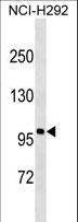 AR / Androgen Receptor Antibody - Androgen Receptor Protein western blot of NCI-H292 cell line lysates (35 ug/lane). The AR antibody detected the AR protein (arrow).