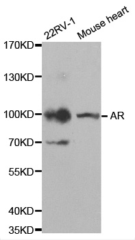 AR / Androgen Receptor Antibody - Western blot analysis of extracts of various cell lines.