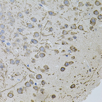 AR / Androgen Receptor Antibody - Immunohistochemistry of paraffin-embedded mouse brain tissue.