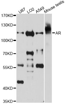 AR / Androgen Receptor Antibody - Western blot analysis of extracts of various cell lines, using AR antibody at 1:1000 dilution. The secondary antibody used was an HRP Goat Anti-Rabbit IgG (H+L) at 1:10000 dilution. Lysates were loaded 25ug per lane and 3% nonfat dry milk in TBST was used for blocking. An ECL Kit was used for detection and the exposure time was 40s.