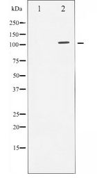 AR / Androgen Receptor Antibody - Western blot of Androgen Receptor expression in LOVO whole cell lysates,The lane on the left is treated with the antigen-specific peptide.