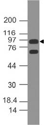 AR / Androgen Receptor Antibody - Fig-1: Westernblot analysis of Androgen receptor. Anti-Androgen receptor antibody was tested at 2 µg/ml on hTestis lysate.