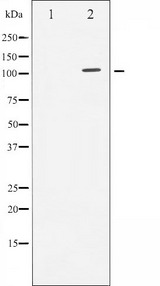 AR / Androgen Receptor Antibody - Western blot analysis of Androgen Receptor expression in LOVO cells whole cells lysates. The lane on the left is treated with the antigen-specific peptide.