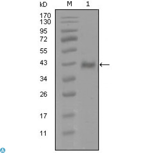AR / Androgen Receptor Antibody - Western Blot (WB) analysis using AR Monoclonal Antibody against truncated Trx-AR recombinant protein (1).