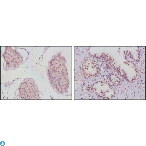 AR / Androgen Receptor Antibody - Western Blot (WB) analysis using AR Monoclonal Antibody against K562 (1), Jurkat (2) and LNCaP (3) cell lysate.