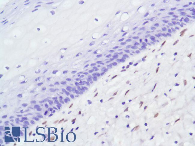 AR / Androgen Receptor Antibody - Immunohistochemistry of Human Cervix stained with anti-Androgen Receptor (AR) antibody