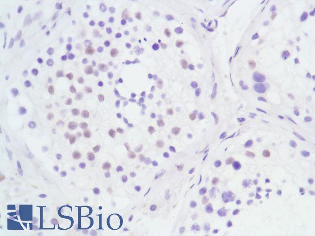 AR / Androgen Receptor Antibody - Immunohistochemistry of Human Testis stained with anti-Androgen Receptor (AR) antibody