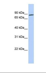 AR / Androgen Receptor Antibody - Jurkat cell lysate. Antibody concentration: 1.0 ug/ml. Gel concentration: 12%.  This image was taken for the unconjugated form of this product. Other forms have not been tested.