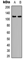 AR / Androgen Receptor Antibody - Western blot analysis of Androgen Receptor (pS213) expression in HepG2 (A); HeLa (B) whole cell lysates.