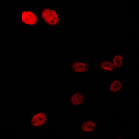 AR / Androgen Receptor Antibody - Immunofluorescent analysis of Androgen Receptor (pS213) staining in HeLa cells. Formalin-fixed cells were permeabilized with 0.1% Triton X-100 in TBS for 5-10 minutes and blocked with 3% BSA-PBS for 30 minutes at room temperature. Cells were probed with the primary antibody in 3% BSA-PBS and incubated overnight at 4 ??C in a humidified chamber. Cells were washed with PBST and incubated with a DyLight 594-conjugated secondary antibody (red) in PBS at room temperature in the dark. DAPI was used to stain the cell nuclei (blue).